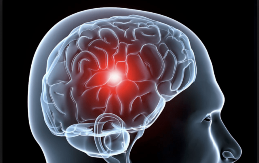 Neurociencia: terapia innovadora