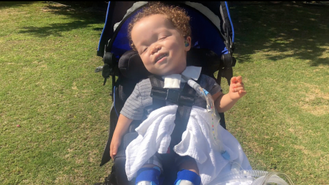 Gabriel Posadas, 2, born with with a rare genetic disorder called Larsen’s Syndrome, which affects the development of bones throughout the body.