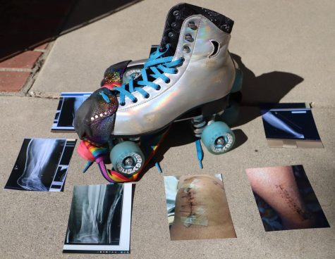 Photo of the roller skates on the beige ground with photos of xrays placed around them.